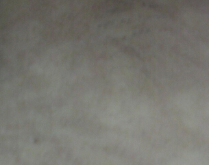 人ĸΰҽԺãĳ֢״Щ