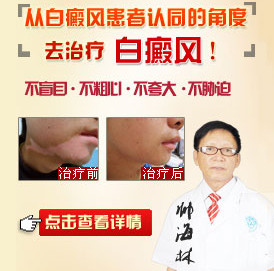 <a href=https://m.shjihong.com.cn/ target=_blank class=infotextkey>武汉白癜风医院</a>.jpg