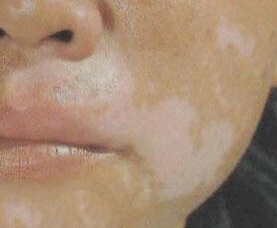人ưϺã人ҽأ